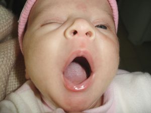 criança bocejando, quanto tempo criança precisa dormir